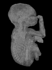 Foetus - volume rendered ultrasound datas