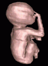 Foetus - centroid guided interpolation