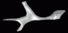 Hepatic system - new disc guided interpolation