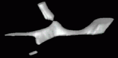 Hepatic system - previous disc guided interpolation